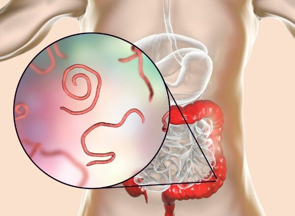 Parasite Cleanse Pack